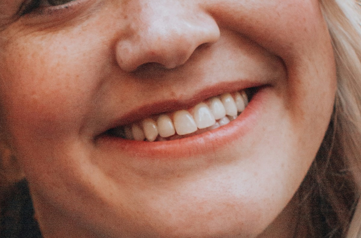 Close-up of a natural smile